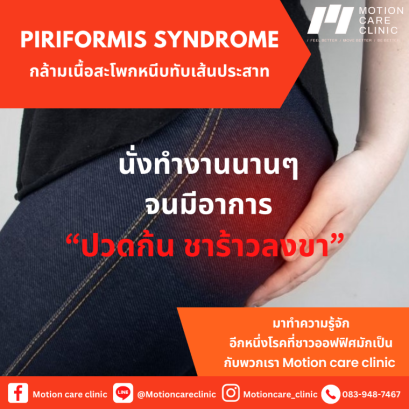 กล้ามเนื้อสะโพกหนีบทับเส้นประสาท (Piriformis Syndrome)