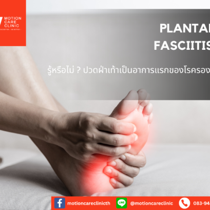 Plantar Fasciitis หรือ โรครองช้ำ หรือ โรคเอ็นฝ่าเท้าอักเสบ