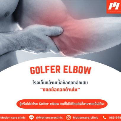 "ปวดข้อศอกด้านใน"  Golfer Elbow โรคเอ็นกล้ามเนื้อข้อศอกด้านในอักเสบ 