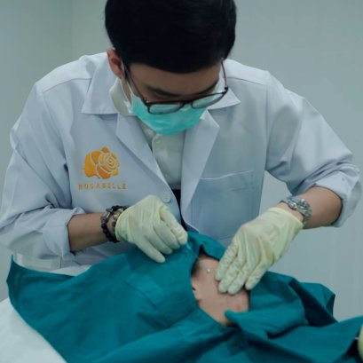 ร้อยไหมคืออะไร? ร้อยไหมหน้าเรียวที่ Rosabelle Clinic