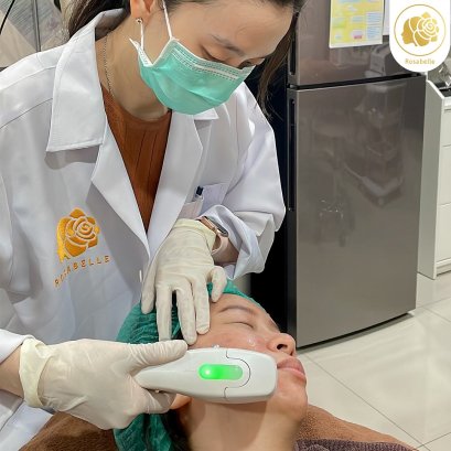 Linear HIFU skin lifting and skin sagging