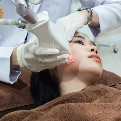 ลดรูขุมขน ที่โรสเบลล์คลินิก (Rosabelle Clinic)