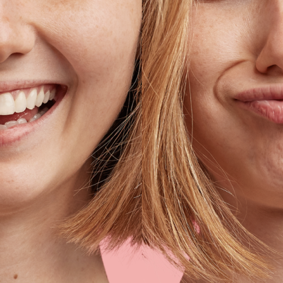 วิธีแก้รอยย่นรอยบุ๋มที่คางเวลาแสดงสีหน้า 