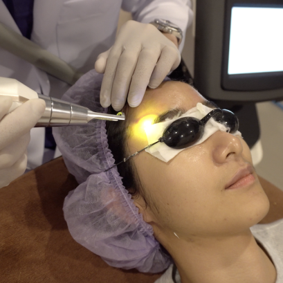 รักษารอยสิว เลเซอร์รักษารอยสิวอย่างเห็นผล ที่โรสเบลล์คลินิก