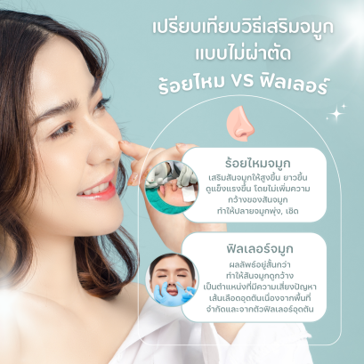 ร้อยไหมจมูก VS ฟิลเลอร์จมูก