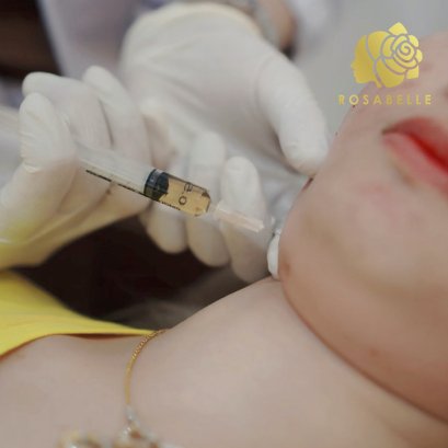 เมโสแฟต สลายไขมัน คืออะไร? ข้อปฏิบัติหลังการฉีดแฟต