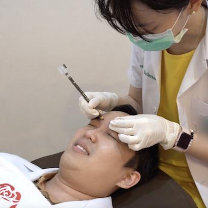 โบท็อกซ์ลดริ้วรอย ที่โรสเบลล์คลินิก