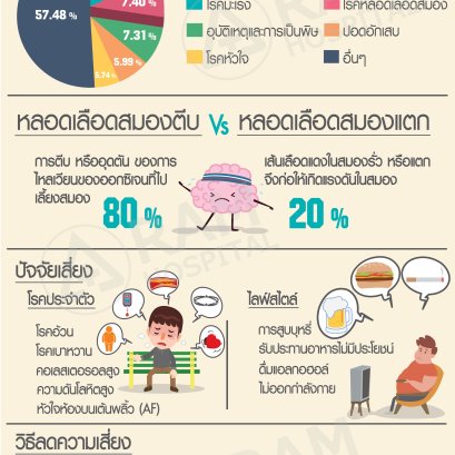 ‘โรคหลอดเลือดสมอง’ เวลาชีวิตที่หล่นหายของผู้สูงอายุไทย