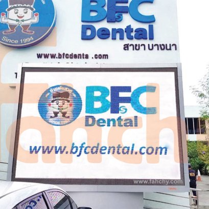 LED P6 outdoor ทันตกรรม