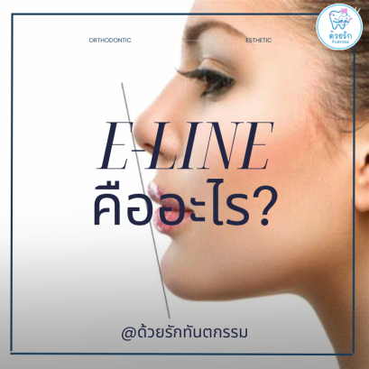 E-line คืออะไร ส่งผลกับฟันอย่างไร?