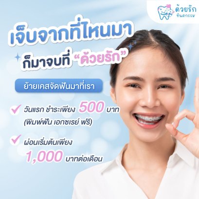 ย้ายเคสจัดฟัน