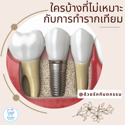 ใครบ้างที่ไม่เหมาะสมกับการทำรากฟันเทียม