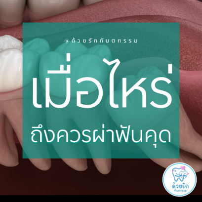 เมื่อไหร่ควรผ่าฟันคุด?