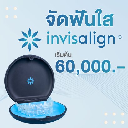 จัดฟันใส invisalign
