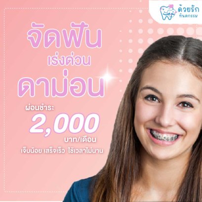 จัดฟันดาม่อน