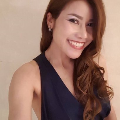 "ร้อยไหมหน้าเด็ก,ร้อยไหมรอบดวงตา+ปลายตา" กับคุณหมอไก่ 	ประสบการณ์ตรงของ คุณไม้ อายุ 48 ปี จาก ขอนแก่น