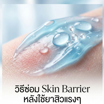 รักษาสิวจนหน้าพัง? วิธีซ่อม Skin Barrier หลังใช้ยาสิวแรงๆ ให้ผิวกลับมาอิ่มน้ำ ไม่ลอก ไม่แดง