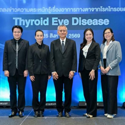 รู้หรือไม่? ไทรอยด์ อาจทำร้ายดวงตา แพทย์เตือนอย่ามองข้ามอาจสูญเสียการมองเห็น