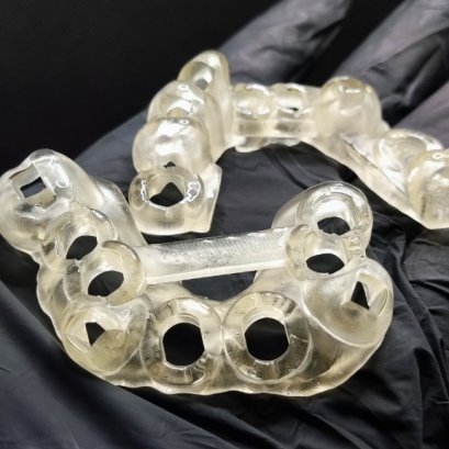 Neobiotech implant all on 