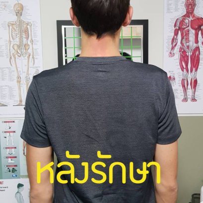 หนุ่มฝรั่งเศสมารักษาทรวดทรงไม่สมดุล (Poor Posture) ตัวเอียง ขาไม่เท่ากัน