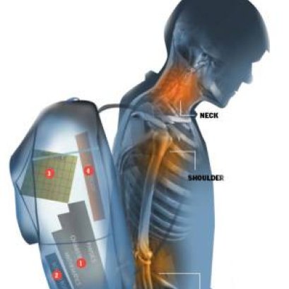 ปัญหาจากการสะพายเป้หนัก: ภัยเงียบที่คุกคามสุขภาพของลูกรัก