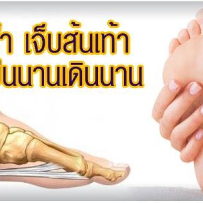 วิธีรักษาให้ลาขาด " รองช้ำ เจ็บส้นเท้า เพราะยืนนานเดินนาน "