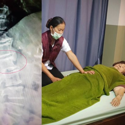 คุณยายวัย 80 มานวดรักษาอาการปวดสะโพกร้าวลงขา ชาเท้า