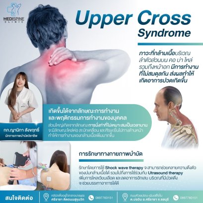 Upper Cross Syndrome ภาวะกล้ามเนื้อคอ บ่า ไหล่ ทำงานไม่สมดุล