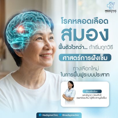 โรคหลอดเลือดสมอง ทำอย่างไรให้ฟื้นตัวได้เร็ว? เคล็ดลับกู้คืนร่างกายในช่วงเวลาทอง