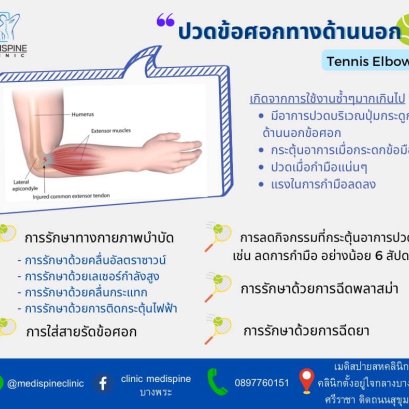 ปวดข้อศอกทางด้านนอก