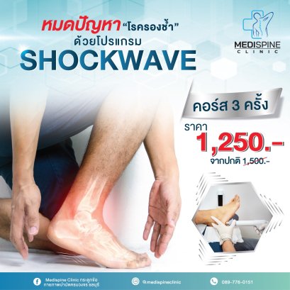 SHOCKWAVE รักษาโรครองช้ำ