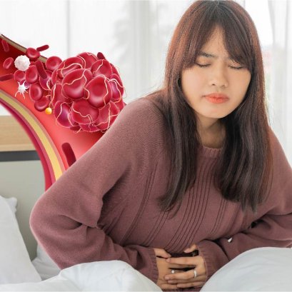 กรดไหลย้อน ต้องบำรุงเลือด