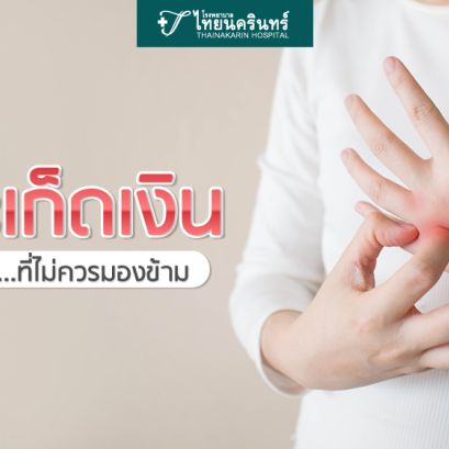 ‘โรคสะเก็ดเงิน’ ปัญหาผิวหนัง…ที่ไม่ควรมองข้าม