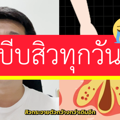 บีบสิวเองทุกวัน แต่หน้ายิ่งพังกว่าเดิม