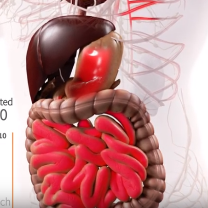 CoQ10 - Ubiquinol or Ubiquinone? | Pharma Nord