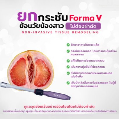  Forma V เลเซอร์กระชับน้องสาว เพิ่มความมั่นใจให้น้องสาว