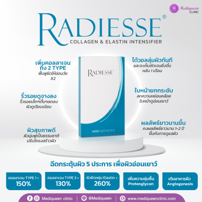radiesse กระตุ้นคอลลาเจน เติมเต็มใบหน้า ได้งานผิว