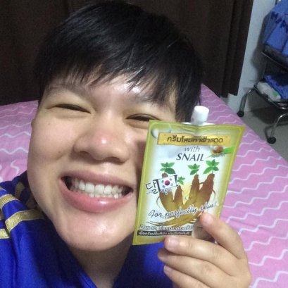 ฝ้าเหรอ? โยนทุกครีมทิ้งไป ลองใช้ตัวเดียว!