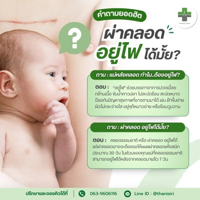 "ผ่าคลอด" อยู่ไฟได้มั้ย? แล้วทำไม....คลอดแล้วต้องอยู่ไฟ? วันนี้ธนิศิริมีคำตอบ 