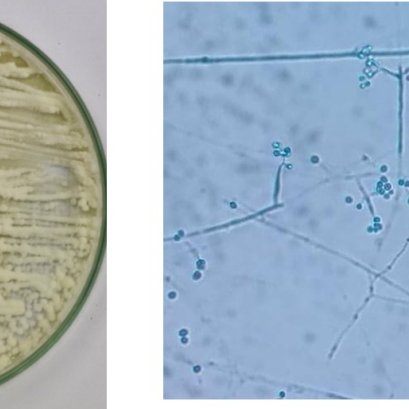 เชื้อราบิวเวอร์เรีย กำจัดศัตรูพืชเศรษฐกิจหลายชนิด