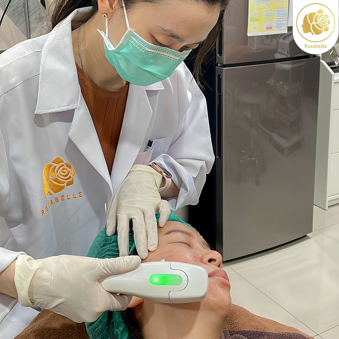 Linear HIFU skin lifting and skin sagging - rosabelleclinic