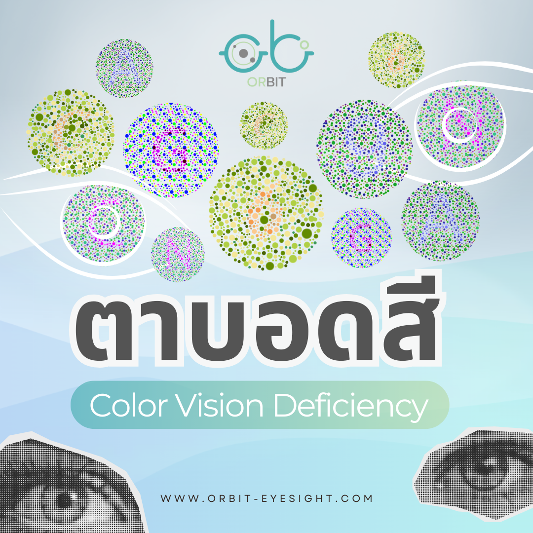 Color Deficit Sploches ตาบอดสี (Color Blindness/Color Vision Deficiency) คืออะไร