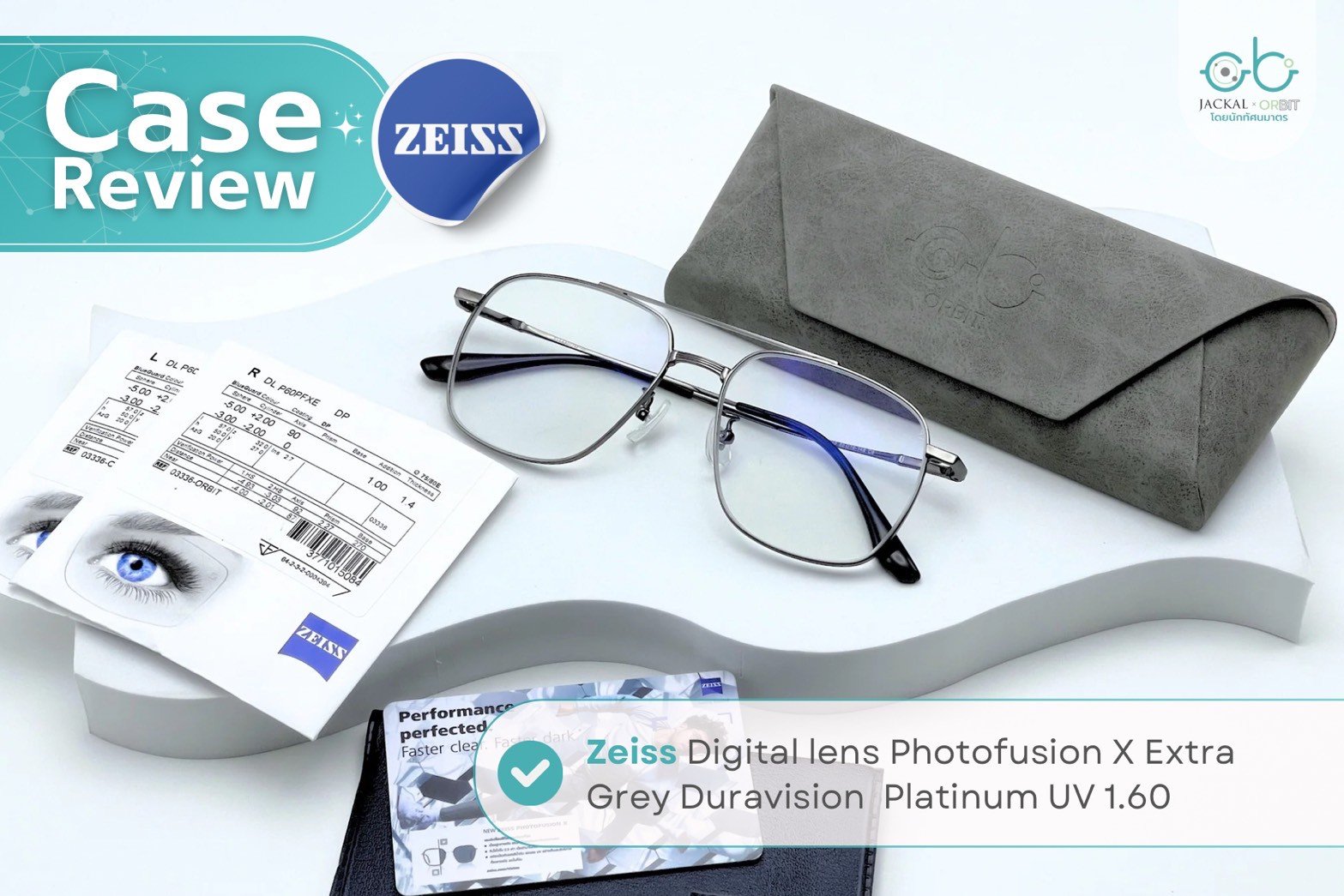 Case review  เคสคุณณัฐกรณ์   โดยร้านแว่นตา Jackal x Orbit โดยนักทัศนมาตร เชียงใหม่ Case review  เคสคุณณัฐกรณ์   โดยร้านแว่นตา Jackal x Orbit โดยนักทัศนมาตร เชียงใหม่