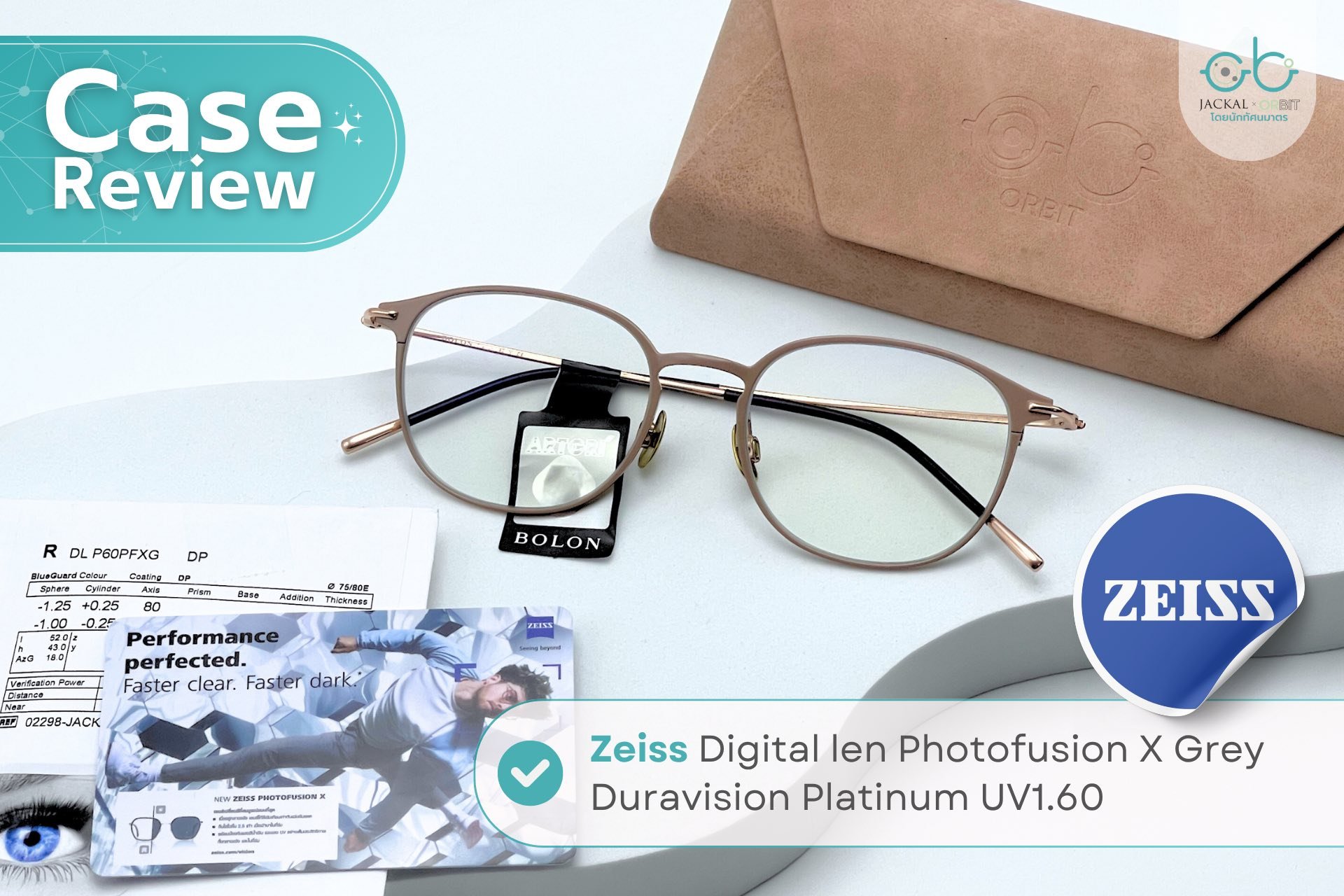 Case review  เคสคุณณัฐกานต์ โดยร้านแว่นตา Jackal x Orbit โดยนักทัศนมาตร เชียงใหม่ Case review  เคสคุณณัฐกานต์ โดยร้านแว่นตา Jackal x Orbit โดยนักทัศนมาตร เชียงใหม่