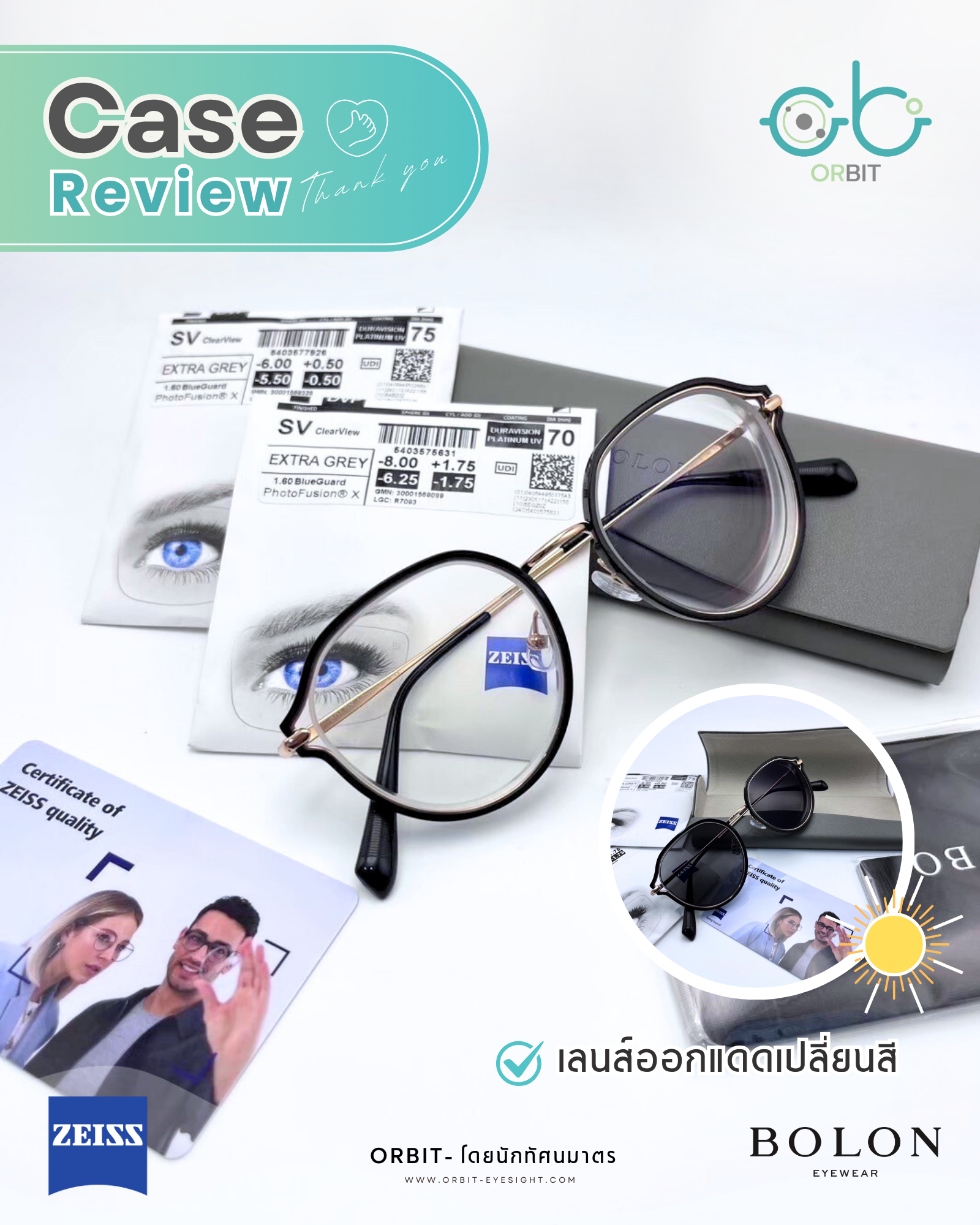 Orbit Case review  : เคสคุณพิมพ์มาดา