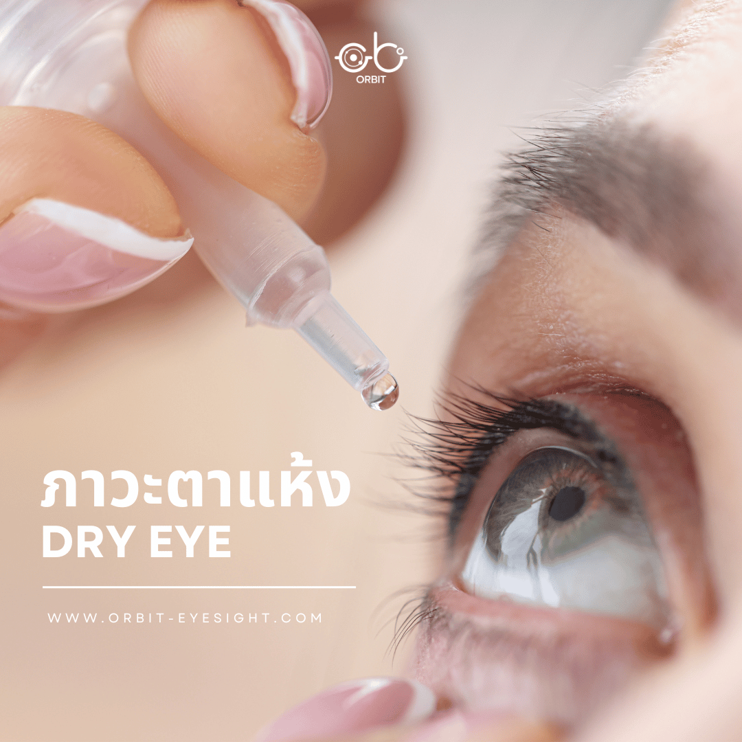 ภาวะตาแห้ง (Dry eye)  ภาวะตาแห้ง (Dry eye)