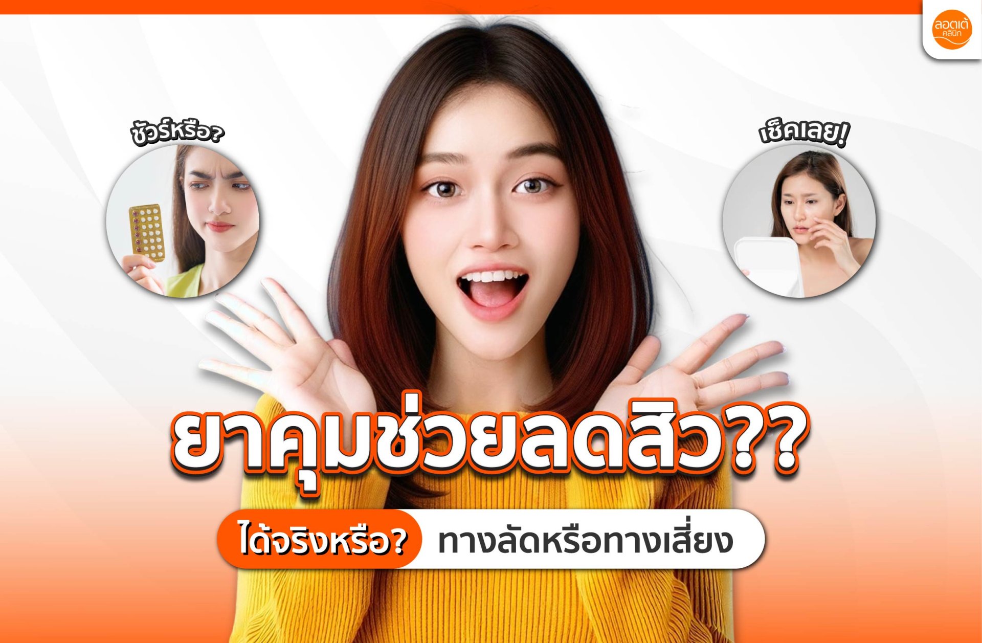 แก้ปัญหาสิวด้วยยาคุม ทางลัดหรือทางเสี่ยง? แก้ปัญหาสิวด้วยยาคุม ทางลัดหรือทางเสี่ยง?