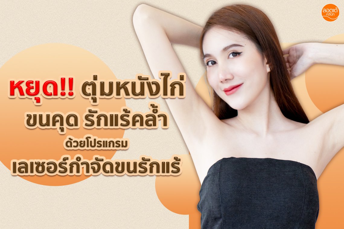 หยุดหนังไก่ รักแร้ดำเป็นขนคุด ด้วยโปรแกรม เลเซอร์กำจัดขนรักแร้ ที่ ลอตเต้คลินิก หยุดหนังไก่ รักแร้ดำเป็นขนคุด ด้วยโปรแกรม เลเซอร์กำจัดขนรักแร้ ที่ ลอตเต้คลินิก