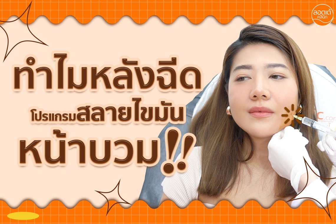 สาเหตุหน้าบวมหลังทำโปรแกรมสลายไขมัน สาเหตุหน้าบวมหลังทำโปรแกรมสลายไขมัน