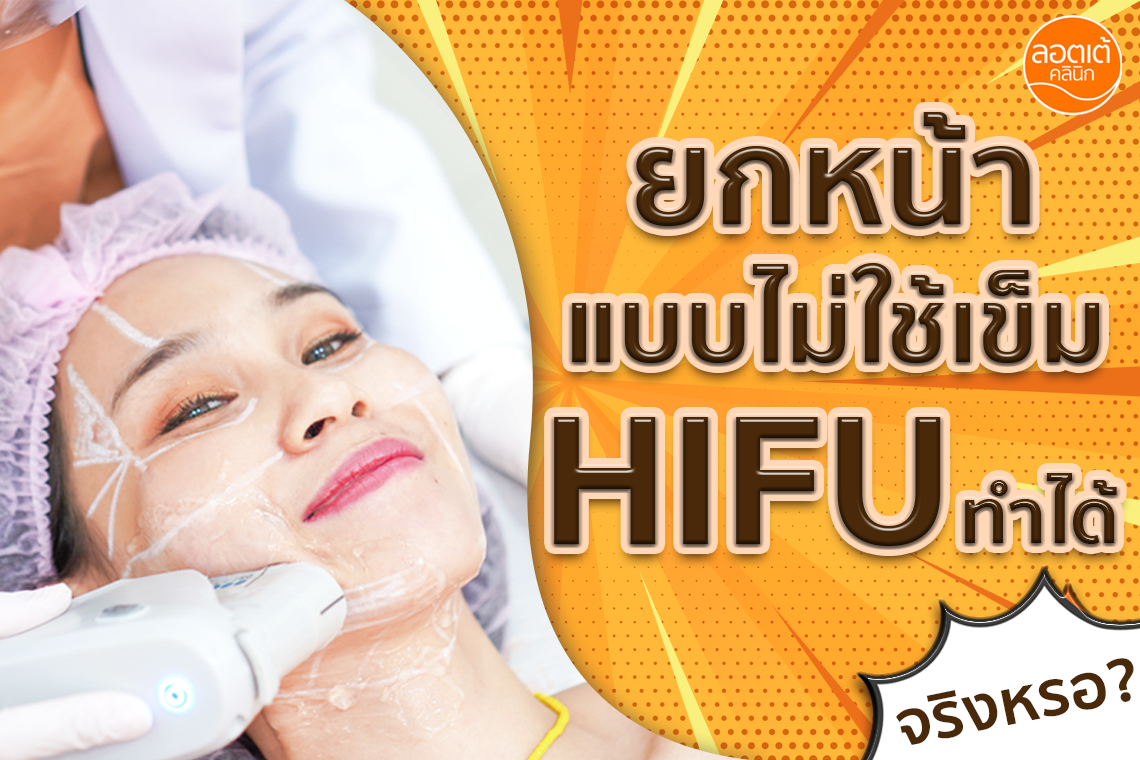 HIFU  ช่วยให้หน้ายกโดยไม่ต้องใช้เข็มจริงไหม ?